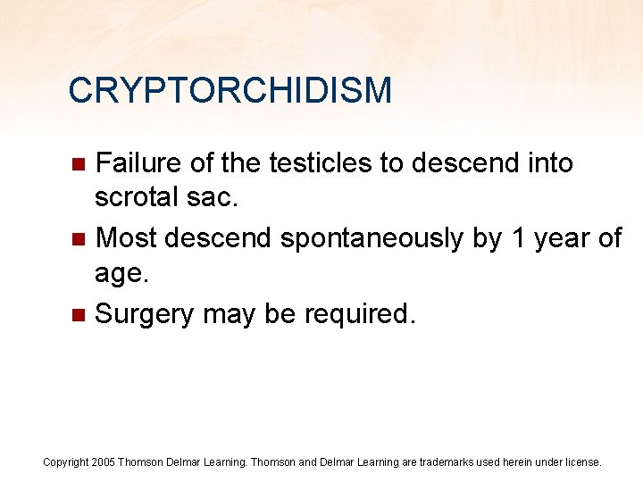 CRYPTORCHIDISM Failure of the testicles to descend into scrotal sac. n Most descend spontaneously