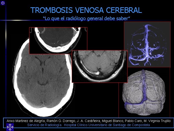 TROMBOSIS VENOSA CEREBRAL “Lo que el radiólogo general debe saber” Anxo Martinez de Alegría,