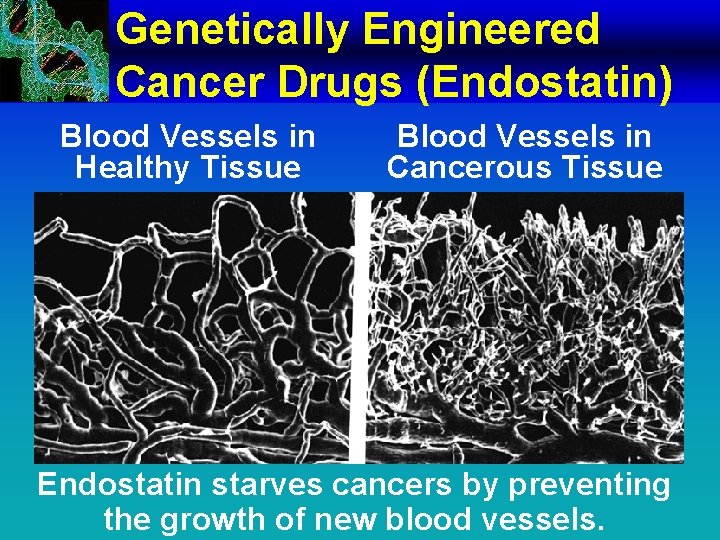 Genetically Engineered Cancer Drugs (Endostatin) Blood Vessels in Healthy Tissue Blood Vessels in Cancerous
