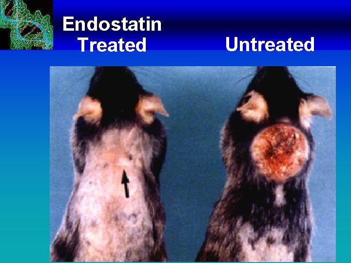 Endostatin Treated Untreated 