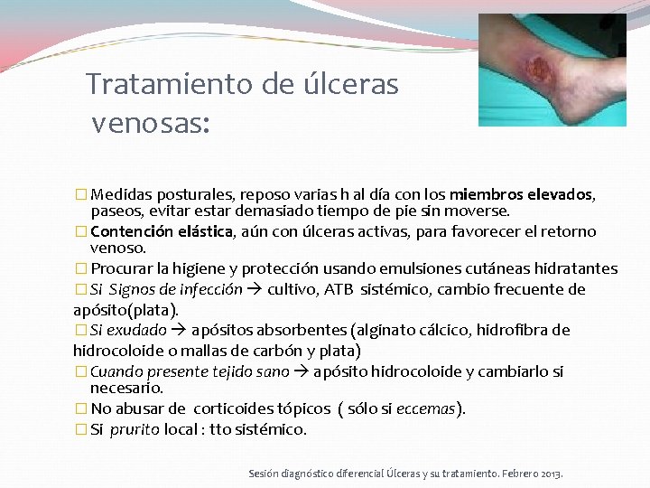 Tratamiento de úlceras venosas: � Medidas posturales, reposo varias h al día con los Tratamiento de úlceras venosas: � Medidas posturales, reposo varias h al día con los