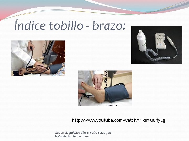 Índice tobillo - brazo: http: //www. youtube. com/watch? v=k. Irvu 6 lfy. Lg Sesión Índice tobillo - brazo: http: //www. youtube. com/watch? v=k. Irvu 6 lfy. Lg Sesión