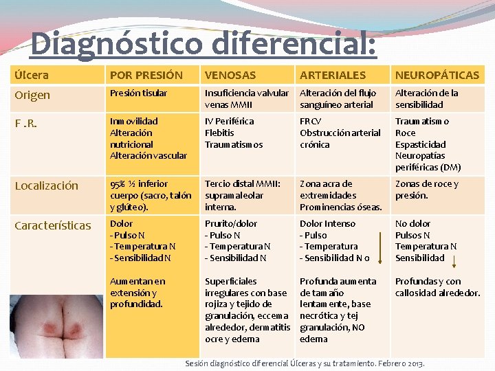 Diagnóstico diferencial: Úlcera POR PRESIÓN VENOSAS ARTERIALES NEUROPÁTICAS Origen Presión tisular Insuficiencia valvular venas Diagnóstico diferencial: Úlcera POR PRESIÓN VENOSAS ARTERIALES NEUROPÁTICAS Origen Presión tisular Insuficiencia valvular venas