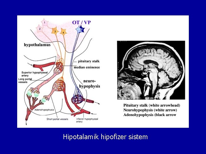 Hipotalamik hipofizer sistem 