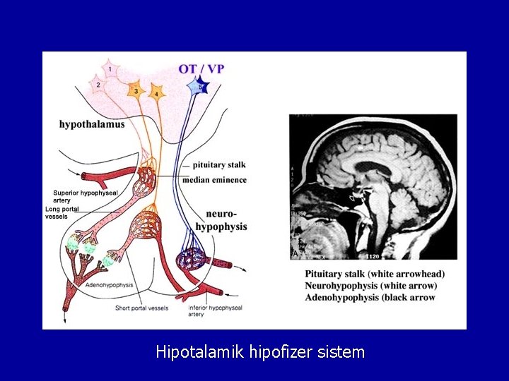 Hipotalamik hipofizer sistem 