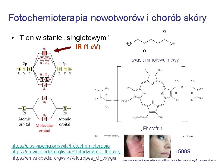 Fotochemioterapia nowotworów i chorób skóry • Tlen w stanie „singletowym” IR (1 e. V)