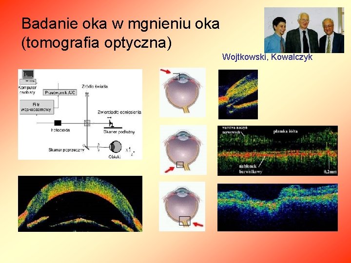 Badanie oka w mgnieniu oka (tomografia optyczna) Wojtkowski, Kowalczyk 