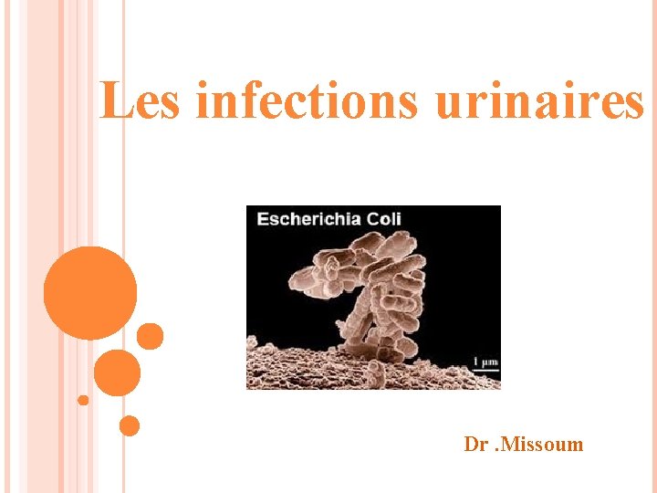 Les infections urinaires Dr. Missoum 