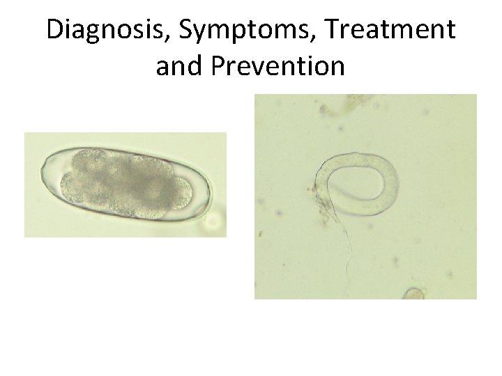 Diagnosis, Symptoms, Treatment and Prevention 