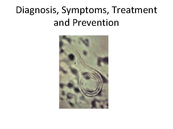 Diagnosis, Symptoms, Treatment and Prevention 