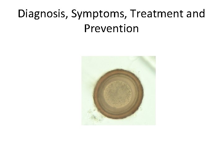 Diagnosis, Symptoms, Treatment and Prevention 