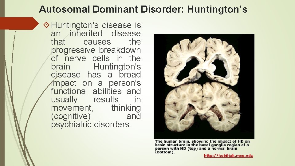 Autosomal Dominant Disorder: Huntington’s Huntington's disease is an inherited disease that causes the progressive