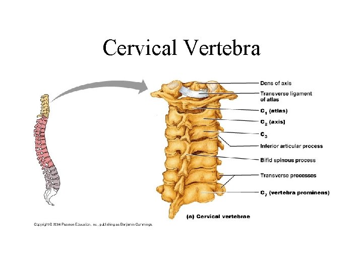 Cervical Vertebra 