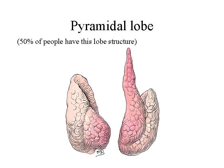 Pyramidal lobe (50% of people have this lobe structure) 