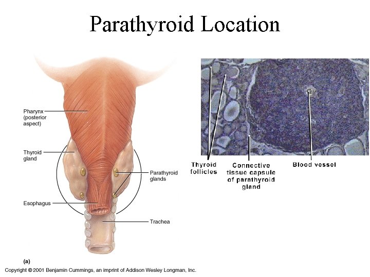 Parathyroid Location 