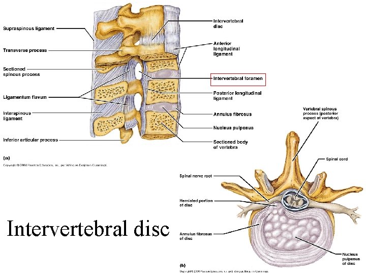 Intervertebral disc 