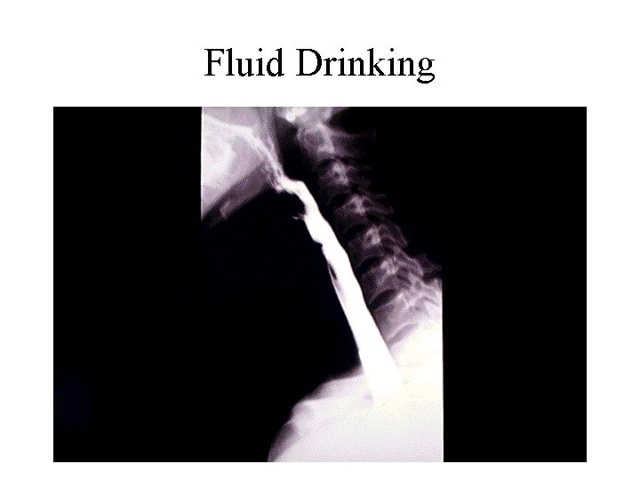 Fluid Drinking 