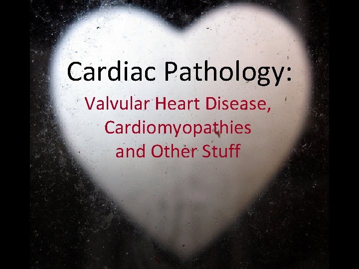Cardiac Pathology: Valvular Heart Disease, Cardiomyopathies and Other Stuff 