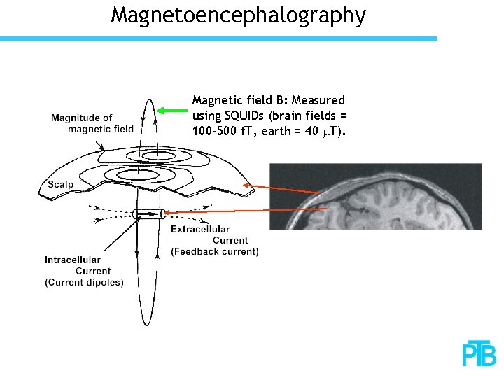 Magnetoencephalography Magnetic field B: Measured using SQUIDs (brain fields = 100 -500 f. T,