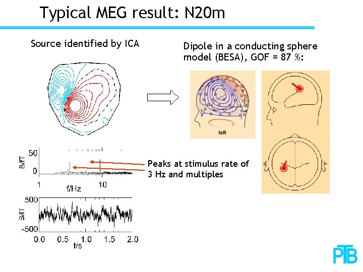 Typical MEG result: N 20 m Source identified by ICA Dipole in a conducting