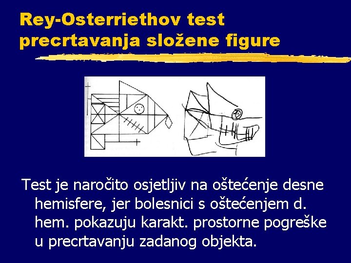 Rey-Osterriethov test precrtavanja složene figure Test je naročito osjetljiv na oštećenje desne hemisfere, jer Rey-Osterriethov test precrtavanja složene figure Test je naročito osjetljiv na oštećenje desne hemisfere, jer