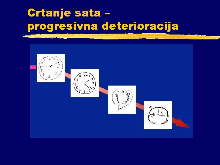 Crtanje sata – progresivna deterioracija 