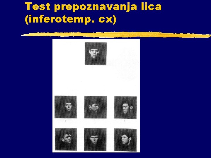 Test prepoznavanja lica (inferotemp. cx) 