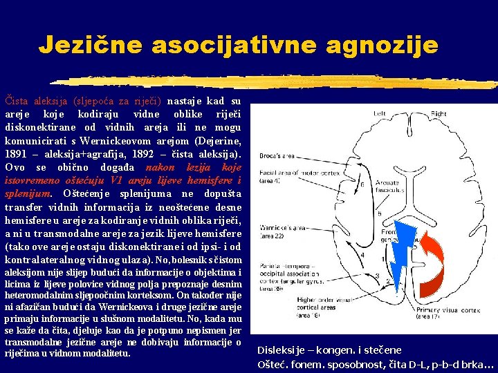 Jezične asocijativne agnozije Čista aleksija (sljepoća za riječi) nastaje kad su areje kodiraju vidne Jezične asocijativne agnozije Čista aleksija (sljepoća za riječi) nastaje kad su areje kodiraju vidne