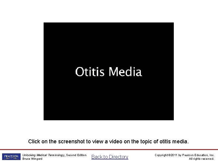 Otitis Media Video Click on the screenshot to view a video on the topic