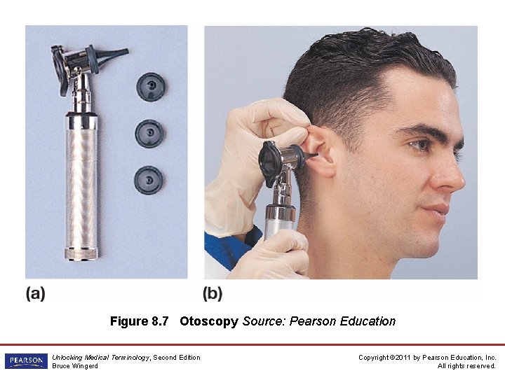 Figure 8. 7 Otoscopy Source: Pearson Education Unlocking Medical Terminology, Second Edition Bruce Wingerd