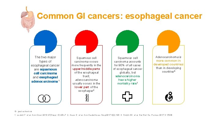 Common GI cancers: esophageal cancer The two major types of esophageal cancer are squamous