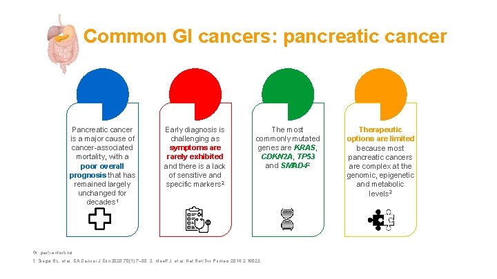 Common GI cancers: pancreatic cancer Pancreatic cancer is a major cause of cancer-associated mortality,