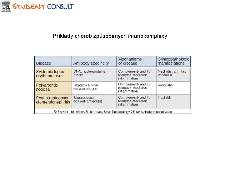 Příklady chorob způsobených imunokomplexy 