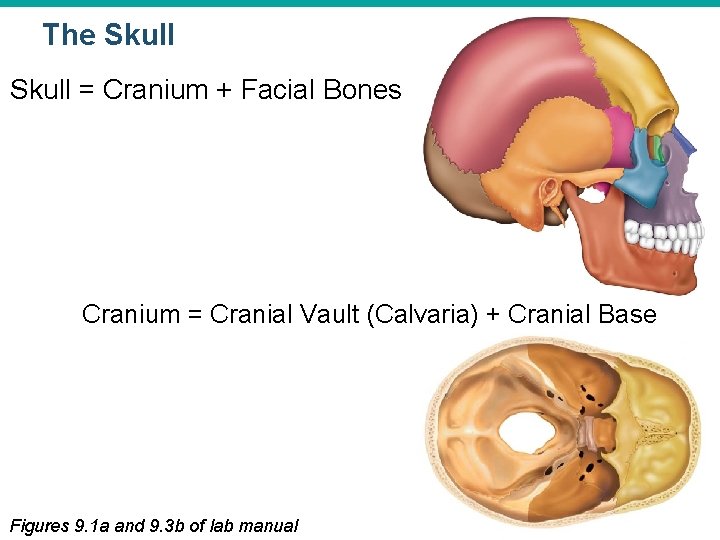 The Skull = Cranium + Facial Bones Cranium = Cranial Vault (Calvaria) + Cranial