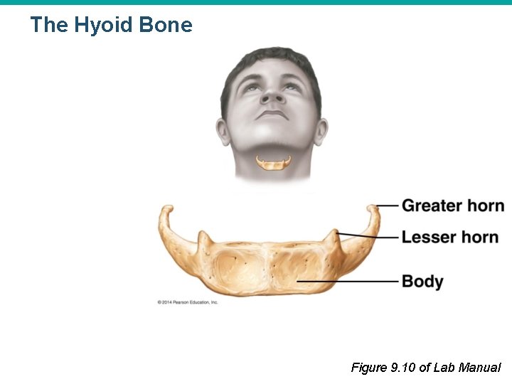 The Hyoid Bone Figure 9. 10 of Lab Manual 