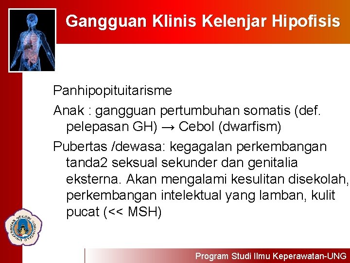 Gangguan Klinis Kelenjar Hipofisis Panhipopituitarisme Anak : gangguan pertumbuhan somatis (def. pelepasan GH) →