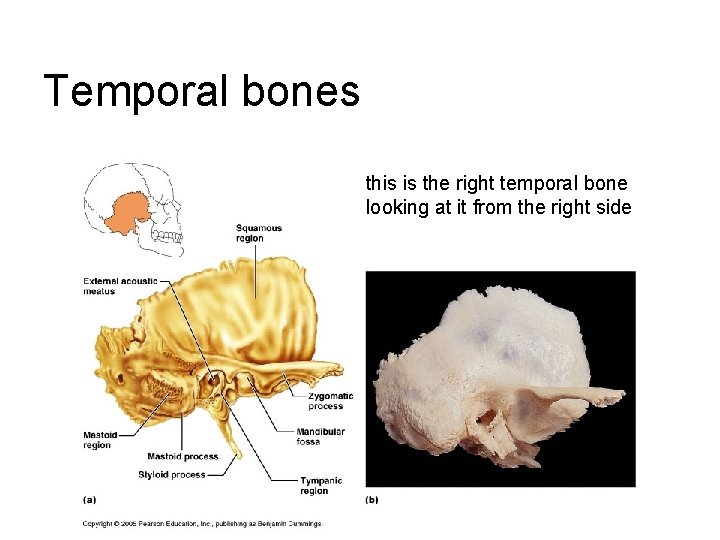 Temporal bones this is the right temporal bone looking at it from the right