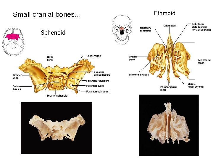 Small cranial bones… Sphenoid Ethmoid 