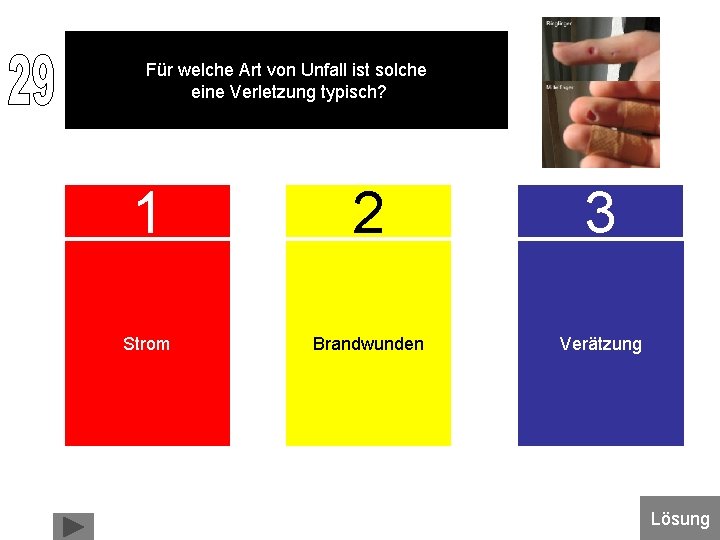 Für welche Art von Unfall ist solche eine Verletzung typisch? 1 2 3 Strom