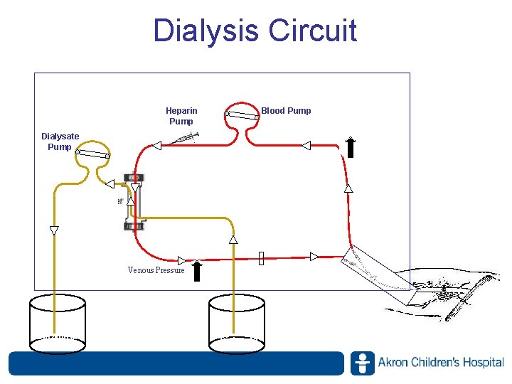 Dialysis Circuit Heparin Pump Blood Pump Arterial Pressure Monitor Dialysate Pump Dialysis Access Venous Dialysis Circuit Heparin Pump Blood Pump Arterial Pressure Monitor Dialysate Pump Dialysis Access Venous