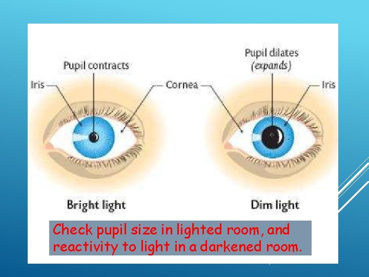 Check pupil size in lighted room, and reactivity to light in a darkened room.