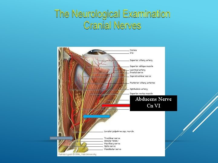 Abducens Nerve Cn VI Oculomotor Nerve Cn III Trochlear Nerve c. n. IV 