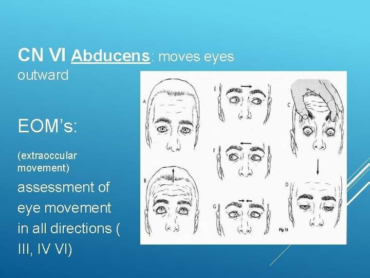 CN VI Abducens: moves eyes outward EOM’s: (extraoccular movement) assessment of eye movement in