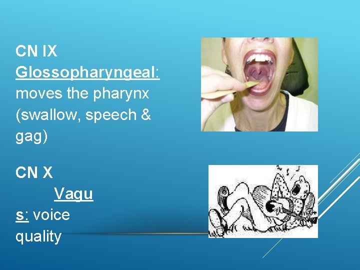 CN IX Glossopharyngeal: moves the pharynx (swallow, speech & gag) CN X Vagu s: