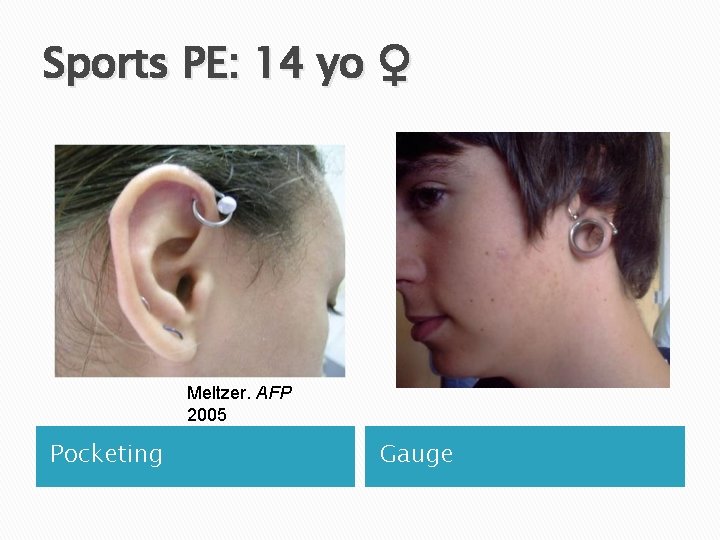 Sports PE: 14 yo ♀ Meltzer. AFP 2005 Pocketing Gauge 