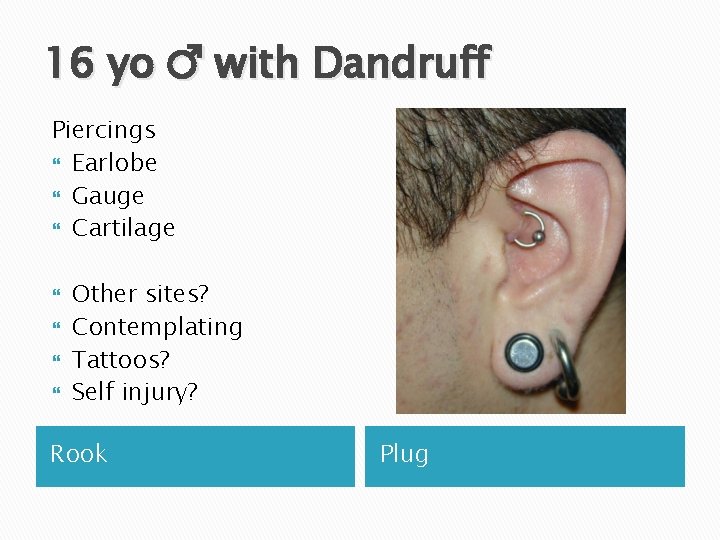 16 yo ♂ with Dandruff Piercings Earlobe Gauge Cartilage Other sites? Contemplating Tattoos? Self