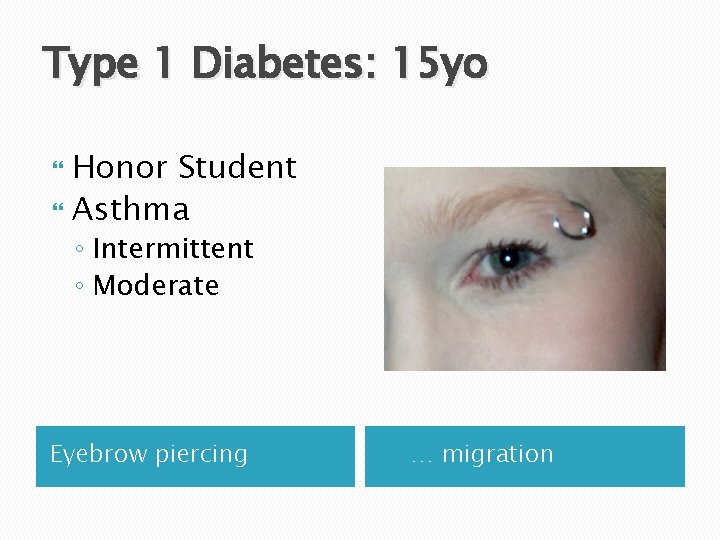 Type 1 Diabetes: 15 yo Honor Student Asthma ◦ Intermittent ◦ Moderate Eyebrow piercing