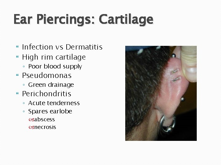 Ear Piercings: Cartilage Infection vs Dermatitis High rim cartilage ◦ Poor blood supply Pseudomonas