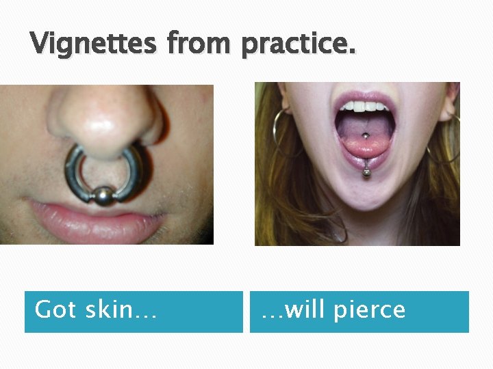 Vignettes from practice. Got skin… …will pierce 