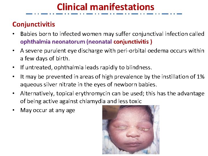 Clinical manifestations Conjunctivitis • Babies born to infected women may suffer conjunctival infection called